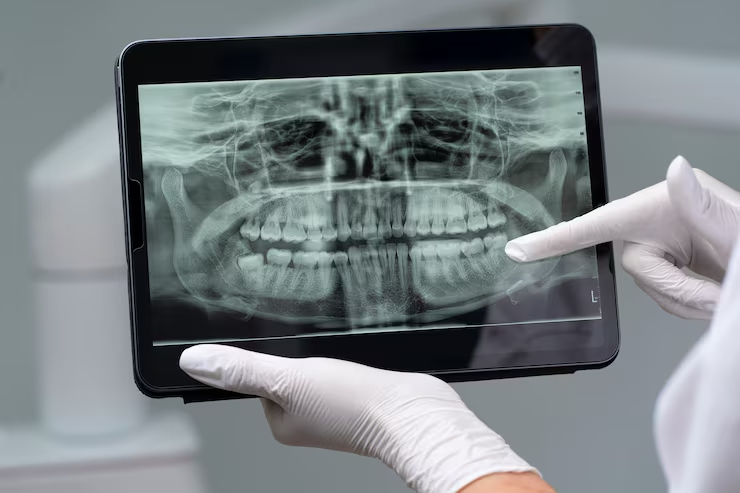 202507311102414243191_oral_medical_and_radiology1